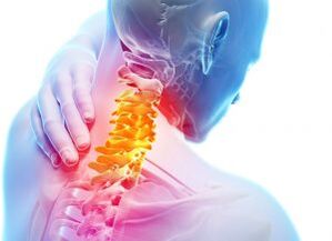Dor e refuxios na zona cervical co terceiro grao de osteocondrose